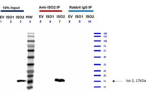 Feimin (Isoform 2) Immunoprecipitation (IP) followed by Western Blot (WB) analyses.