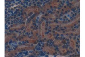 Immunohistochemistry (IHC) image for anti-Complement Factor H (CFH) (AA 915-1156) antibody (ABIN7432277)