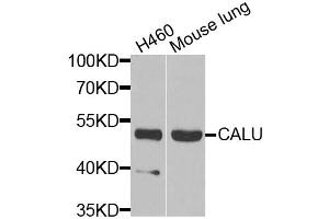 Western blot analysis of extracts of various cell lines, using CALU antibody (ABIN5973922) at 1/1000 dilution.
