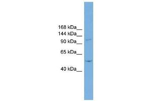TNNI3K antibody used at 1 ug/ml to detect target protein. (TNNI3K antibody  (N-Term))