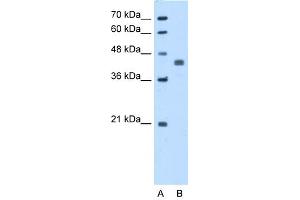 WB Suggested Anti-PDHA1 Antibody Titration:  5. (PDHA1 antibody  (N-Term))