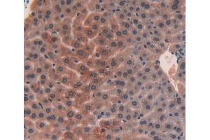 Used in DAB staining on fromalin fixed paraffin- embedded liver tissue (UQCRB antibody  (AA 3-111))