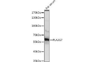 Western blot analysis of extracts of Rat serum, using PLG7 Rabbit pAb (ABIN6131874, ABIN6145735, ABIN6145737 and ABIN6225094) at 1:1000 dilution.