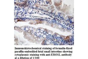 Image no. 1 for anti-ERO1-Like Protein alpha (ERO1L) antibody (ABIN1576363) (ERO1L antibody)