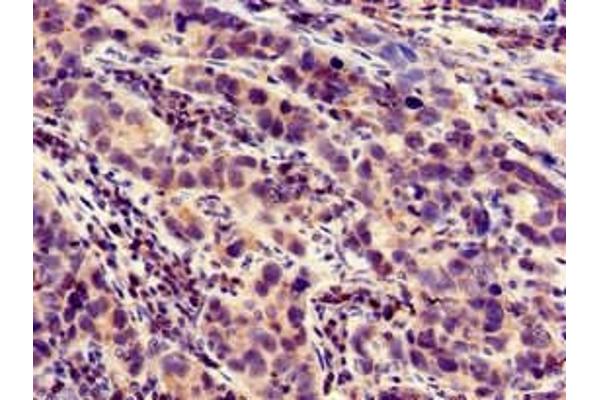 LOXHD1 antibody  (AA 1101-1366)