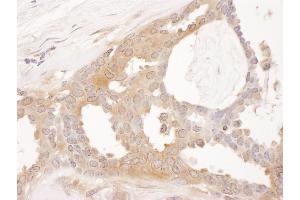Immunohistochemistry (IHC) image for anti-Chaperonin Containing TCP1, Subunit 8 (Theta) (CCT8) (AA 1-50) antibody (ABIN7453618) (CCT8 antibody  (AA 1-50))