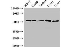 Western Blot Positive WB detected in: MCF-7 whole cell lysate, HepG2 whole cell lysate, Jurkat whole cell ltysate, Mouse liver tissue, Rat liver tissue All lanes: KAT8 antibody at 3 μg/mL Secondary Goat polyclonal to rabbit IgG at 1/50000 dilution Predicted band size: 53, 54 kDa Observed band size: 53 kDa (MYST1 antibody  (AA 1-168))