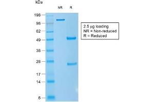 SDS-PAGE analysis of purified, BSA-free recombinant CD1a antibody (clone rC1A/711) as confirmation of integrity and purity. (CD1a antibody)