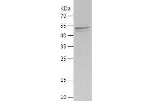 Western Blotting (WB) image for KIAA0226 (KIAA0226) (AA 10-278) protein (His-IF2DI Tag) (ABIN7123683) (Rubicon Protein (AA 10-278) (His-IF2DI Tag))