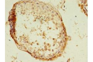Immunohistochemistry of paraffin-embedded human testis tissue using ABIN7157249 at dilution of 1:100 (KBTBD4 antibody  (AA 151-415))