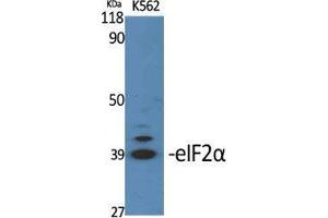 Western Blot (WB) analysis of specific cells using eIF2alpha Polyclonal Antibody. (EIF2A antibody  (Ser326))