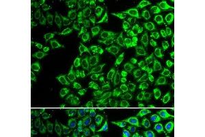 Immunofluorescence analysis of A549 cells using LIPC Polyclonal Antibody (LIPC antibody)