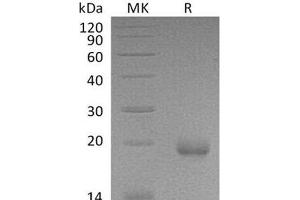 Western Blotting (WB) image for Interferon zeta (IFNZ) protein (His tag) (ABIN7320569) (Interferon zeta Protein (IFNZ) (His tag))