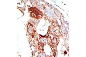 Image no. 2 for anti-SUMO1/sentrin Specific Protease 6 (SENP6) (C-Term) antibody (ABIN356759) (SENP6 antibody  (C-Term))