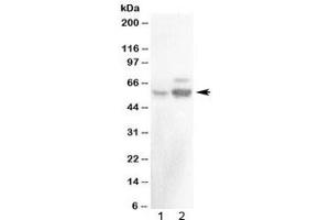 Western blot testing of 1) rat testis and 2) mouse testis with ALDH1A2 antibody at 0. (ALDH1A2 antibody)