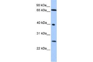 Western Blotting (WB) image for anti-Lethal(3) Malignant Brain Tumor-Like Protein 2 (L3MBTL2) antibody (ABIN2457889)