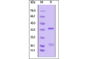 FCGRT & B2M (AA 24-297) protein (His tag,AVI tag,Biotin)