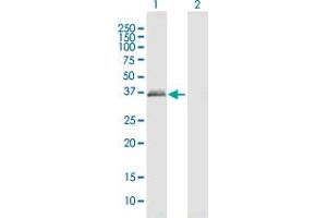 PRPH2 antibody  (AA 1-346)