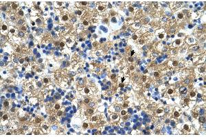 Human Liver (CTP Synthase antibody  (N-Term))