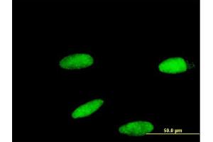 Immunofluorescence of monoclonal antibody to ZNF587 on HeLa cell. (ZNF587 antibody  (AA 1-122))