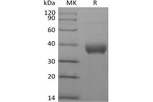 Western Blotting (WB) image for Butyrophilin, Subfamily 1, Member A1 (BTN1A1) protein (Biotin,His-Avi Tag) (ABIN7319877) (BTN1A1 Protein (Biotin,His-Avi Tag))