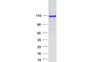 Western Blotting (WB) image for Huntingtin Interacting Protein 1 Related (HIP1R) protein (Myc-DYKDDDDK Tag) (ABIN2722751)