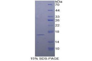SDS-PAGE (SDS) image for T-Cell Leukemia/lymphoma 1A (TCL1A) (AA 1-114) protein (His tag) (ABIN2126904)