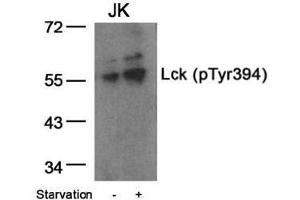 Image no. 1 for anti-Lymphocyte-Specific Protein tyrosine Kinase (LCK) (pTyr394) antibody (ABIN196861) (LCK antibody  (pTyr394))
