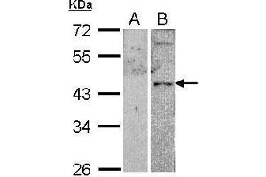 WB Image Western Blot analysis of VPAC2 expression in transfected 293T cell line (20ug of whole cell ltsate) A: Non-transfected lysate. (VIPR2 antibody  (C-Term))