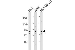 All lanes : Anti-MYSM1 Antibody (N-term) at 1:1000 dilution Lane 1: Hela whole cell lysate Lane 2: Jurkat whole cell lysate Lane 3: MDA-MB-231 whole cell lysate Lysates/proteins at 20 μg per lane.