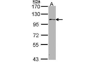 WB Image Sample (30 ug of whole cell lysate) A: Hep G2 , 7. (USP10 antibody  (C-Term))