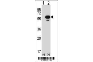 Western blot analysis of Stk25 using rabbit polyclonal Mouse Stk25 Antibody using 293 cell lysates (2 ug/lane) either nontransfected (Lane 1) or transiently transfected (Lane 2) with the Stk25 gene. (STK25 antibody  (C-Term))