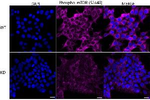 Immunocytochemical staining of HeLa cells using Phospho-mTOR (S(ABIN7800001) antibody (ABIN7799348), 1:1,000), Top panel: wild-type (WT), Bottom panal: Phospho-mTOR (S(ABIN7800001) shRNA knockdown (KD). (Recombinant MTOR antibody  (pSer2448))