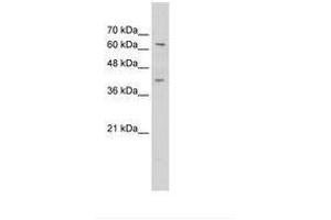 Image no. 1 for anti-Zinc Finger Protein 415 (ZNF415) (C-Term) antibody (ABIN6736301) (ZNF415 antibody  (C-Term))