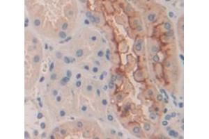 IHC-P analysis of Human Tissue, with DAB staining. (DOCK1 antibody  (AA 1200-1435))