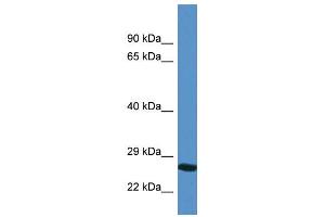 WB Suggested Anti-YIPF4 AntibodyTitration: 1. (YIPF4 antibody  (N-Term))