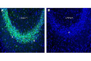 Expression of ZIP10 in mouse hippocampusImmunohistochemical staining of perfusion-fixed frozen mouse brain sections with Anti-ZIP10/SLC39A10 (extracellular) Antibody (ABIN7581978), (1:300), followed by goat anti-rabbit-AlexaFluor-488.