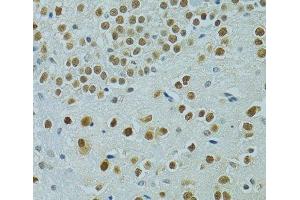 Immunohistochemistry of paraffin-embedded Mouse brain using MUS81 Polyclonal Antibody at dilution of 1:100 (40x lens).