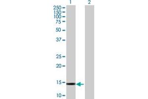 Western Blotting (WB) image for GALNT1 293T Cell Transient Overexpression Lysate(Denatured) (ABIN1331903)