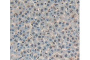 IHC-P analysis of liver tissue, with DAB staining. (DKC1 antibody  (AA 298-509))