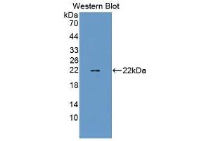 Detection of Recombinant TAZ, Mouse using Polyclonal Antibody to Tafazzin (TAZ) (TAZ antibody  (AA 46-240))