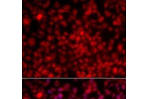 Immunofluorescence analysis of U2OS cells using ILF2 Polyclonal Antibody