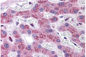 Human Liver: Formalin-Fixed, Paraffin-Embedded (FFPE) (Transmembrane Protein 18 (TMM18) (C-Term) antibody)
