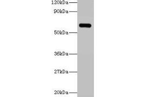 Western blot All lanes: YARS antibody at 2 μg/mL + 293T whole cell lysate Secondary Goat polyclonal to rabbit IgG at 1/15000 dilution Predicted band size: 60 kDa Observed band size: 60 kDa