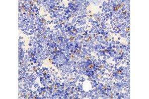 Immunohistochemistry analysis of paraffin-embedded mouse bone using,FCN1 (ABIN7073952) at dilution of 1: 3000 (FCN1 antibody)
