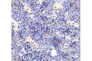 Immunohistochemistry analysis of paraffin-embedded mouse bone using,FCN1 (ABIN7073952) at dilution of 1: 3000