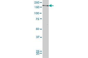 MYPN monoclonal antibody (M04), clone 4C8 Western Blot analysis of MYPN expression in Hela S3 NE . (Myopalladin antibody  (AA 61-170))