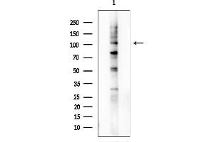 anti-RAB3 GTPase Activating Protein Subunit 1 (Catalytic) (RAB3GAP1) (Internal Region) antibody