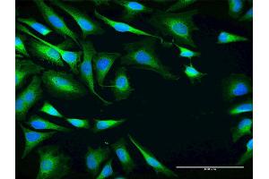 Immunofluorescence of purified MaxPab antibody to SRPR on HeLa cell. (SRPR antibody  (AA 1-638))