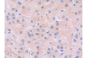 Figure. (JAK2 antibody  (AA 508-800))